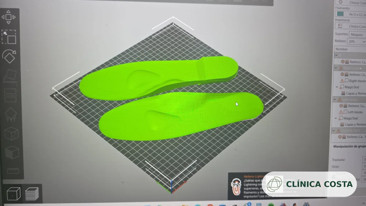 Diseño digital de plantillas ortopédicas personalizadas en software 3D en Clínica Costa